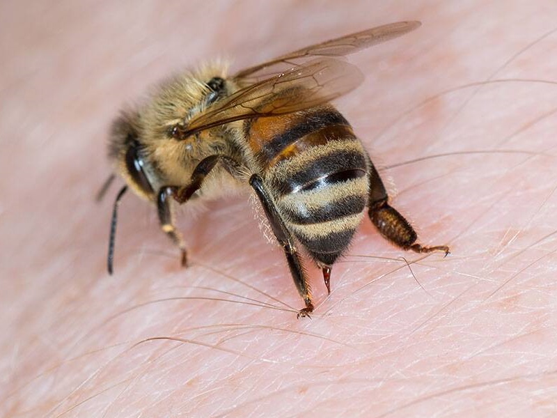 10 legjobb otthoni gyógyszer méhcsípésre