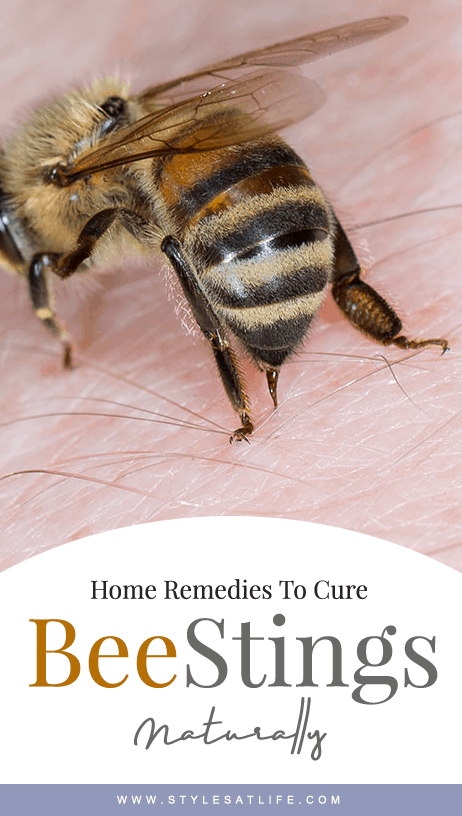 házi gyógymódok méhcsípésre