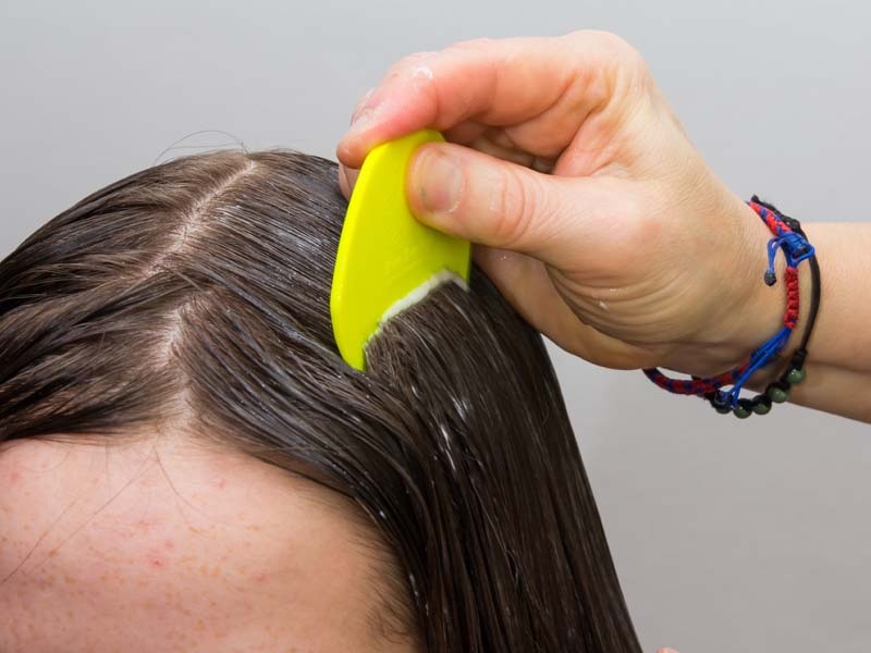 Shampoo til fedtet hovedbund (fedtet hår) i Indien