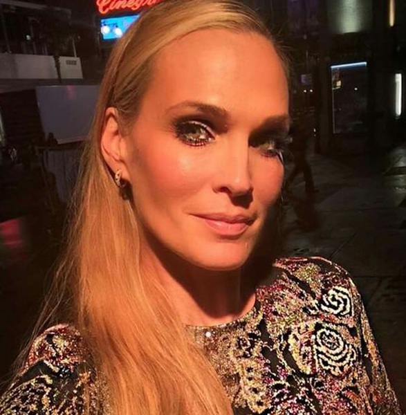 Molly Sims næseform