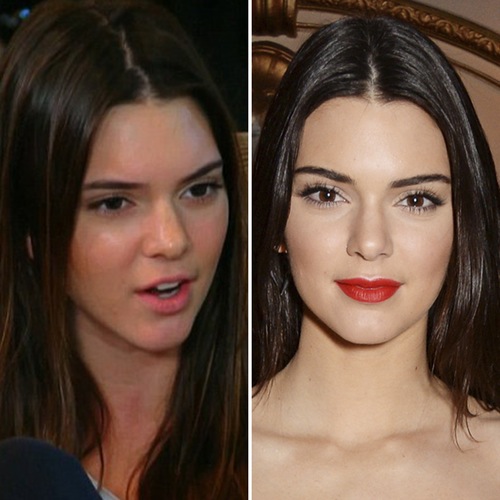 Kendall Jenner uden makeup 11