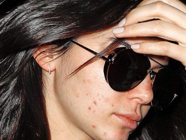 Kendall Jenner uden makeup