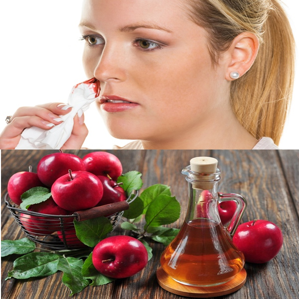 Hjemmemedicin mod stoppet næseblodning
