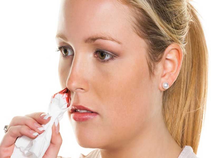 Hjemmemedicin mod næseblødning