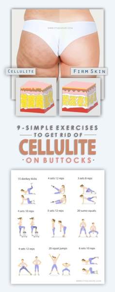 øvelser for at slippe af med cellulite på balder