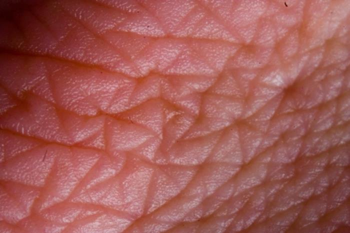 Kollageeni ihoamme Kollageenin kaltainen iho