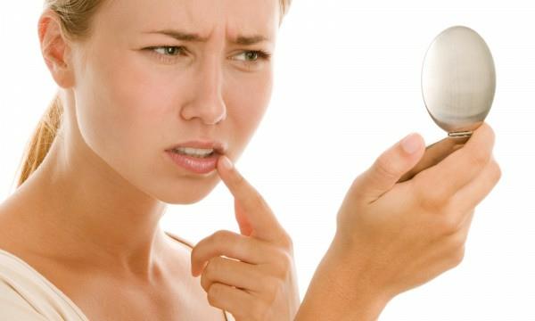 Kylmäkipeä kotiin korjaustoimenpiteitä päästä eroon huuliherpes nopeasti