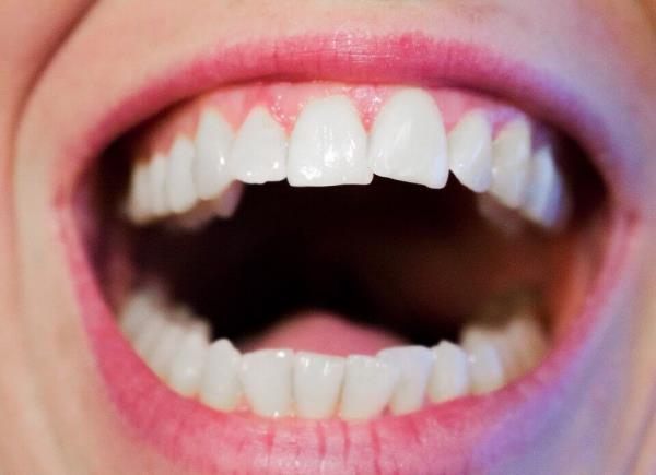 Vinkkejä terveille ikenille ja kauniille hymylle hyvä suuhygienia valkoiset hampaat