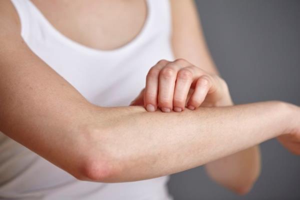 Mikä auttaa kutiavia iho -oireita vastaan