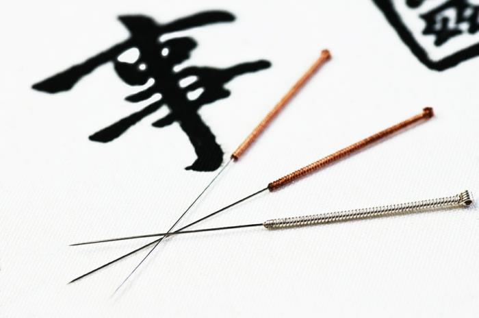 kiinalainen lääketiede laihtumiseen akupunktio neulat