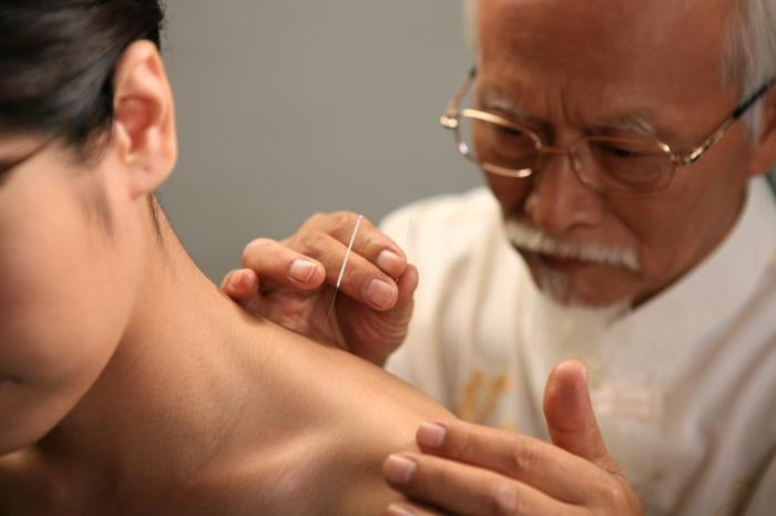 kiinalainen lääketiede laihdutus akupunktio pisteitä