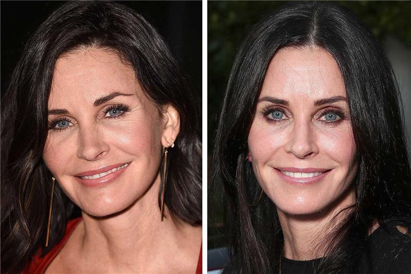 courteney cox -operaatio kauneus op