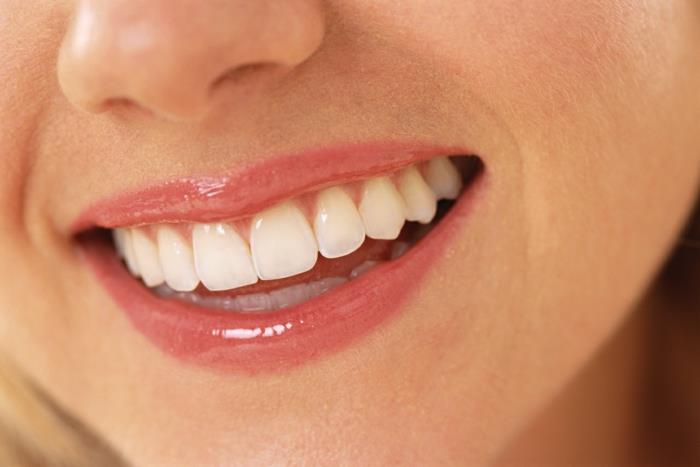 karieksen oireet asianmukainen hammashoito kaunis hymy
