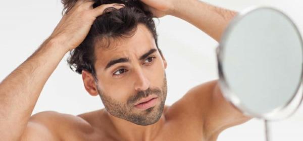 elävät terveet hiustenlähtö miehet vinkkejä