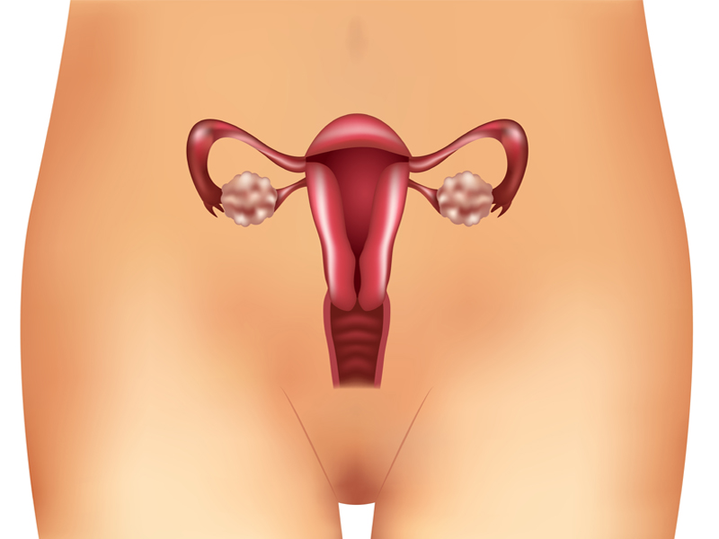 Ovariecyste symptomer og årsager