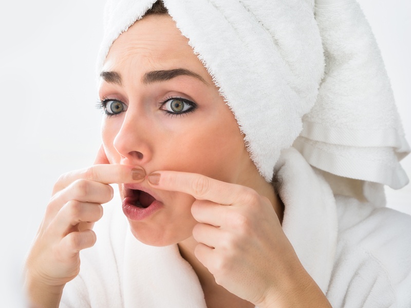 Bedste antibiotika til behandling af acne og bumser