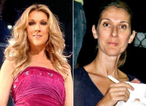 Celine Dion uden makeup 4