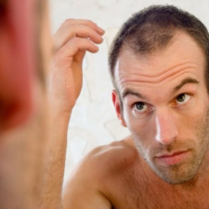 Hogyan okoz hajhullást a DHT?