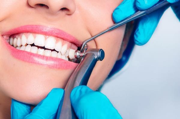 ammattimainen hampaiden ennaltaehkäisy