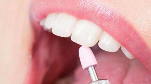 hampaiden kiillotus hampaiden ennaltaehkäisy